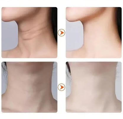 SkinClear™ - ¡50% de descuento hoy!